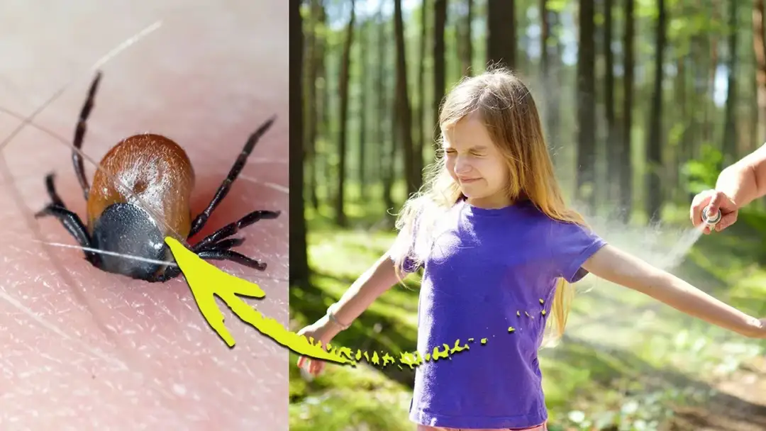 Skuteczne sposoby na odstraszenie kleszczy i uniknięcie niebezpiecznych ugryzień Skuteczne sposoby na odstraszenie kleszczy i uniknięcie niebezpiecznych ugryzień
