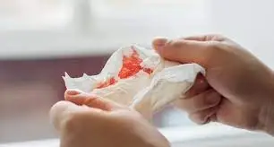 Pojawienie się flegmy z krwią: Sygnały alarmowe wymagające lekarza