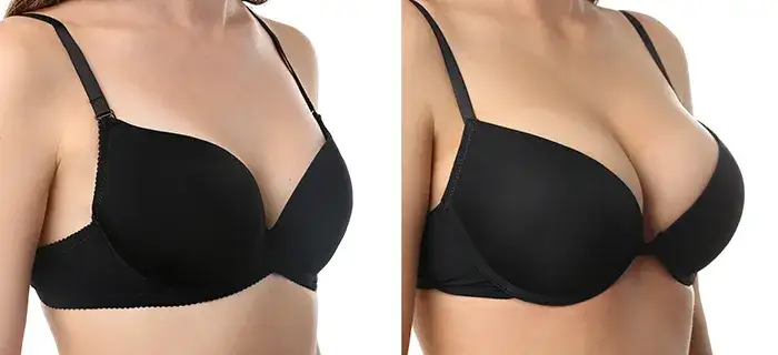 Gdzie zrobić operację biustu? Top 10 klinik i chirurgów w Polsce