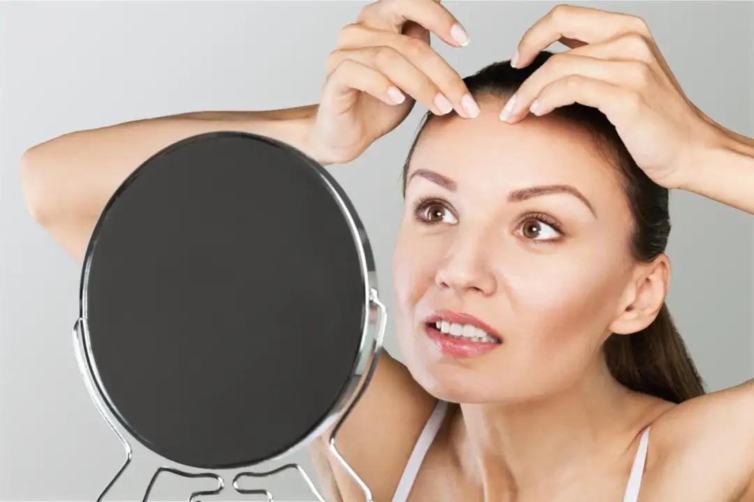 Pryszcze: Skuteczne sposoby! Domowe metody, apteka, dermatolog