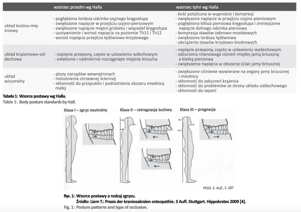 Klasyfikacja ICD-10 pomaga rozpoznać wadę postawy! To kluczowe