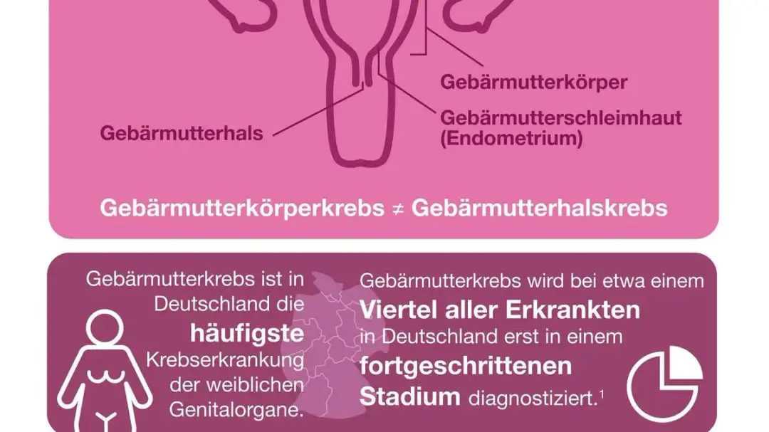 Symptome bei Gebärmutterkrebs: Warnzeichen, die Sie nicht ignorieren sollten