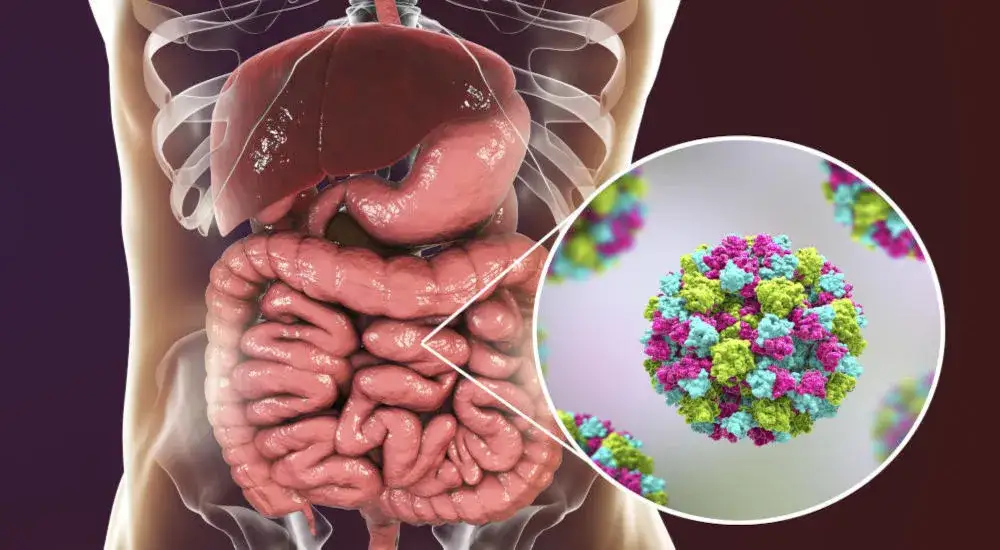 Objawy jelitówki u dorosłych – jak rozpoznać i złagodzić nieprzyjemne dolegliwości