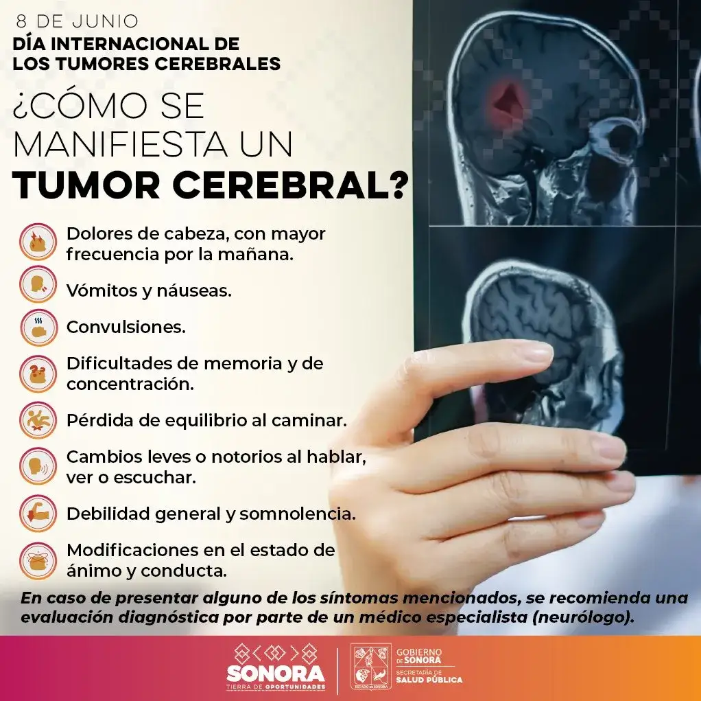 Síntomas de tumor cerebral que no debes ignorar para tu salud