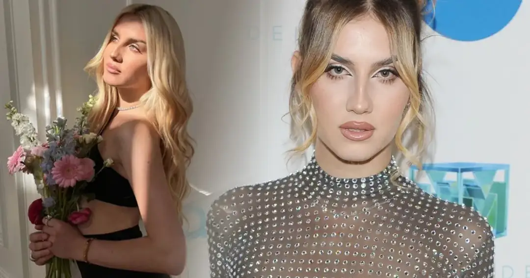 Modelka z bliznami? Tak, to możliwe! Autentyczność to nowy atut w modzie.