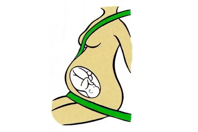 Bezpieczna jazda w ciąży: Jak prawidłowo zapinać pasy, chroniąc siebie i dziecko