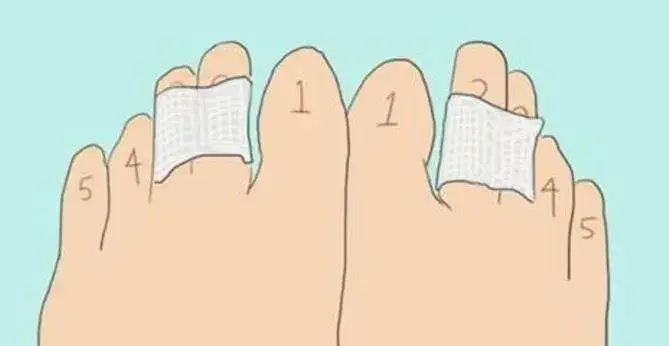 Jak skleić palce do szpilek, aby uniknąć bólu i dyskomfortu