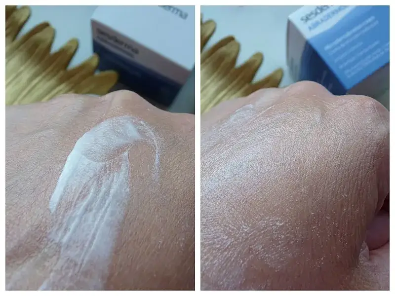 Jaki krem po mikrodermabrazji? Odkryj najlepsze produkty na regenerację