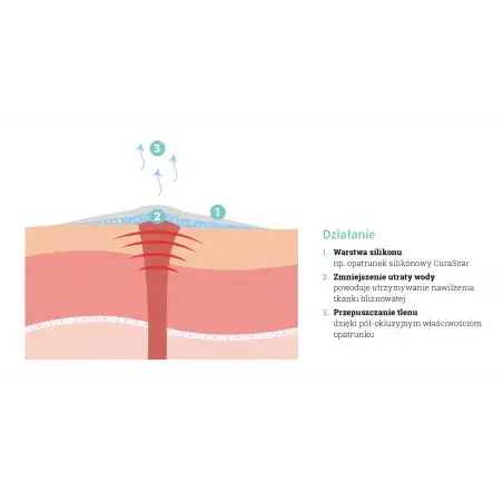 Skuteczne metody na blizny po operacji biustu, które działają