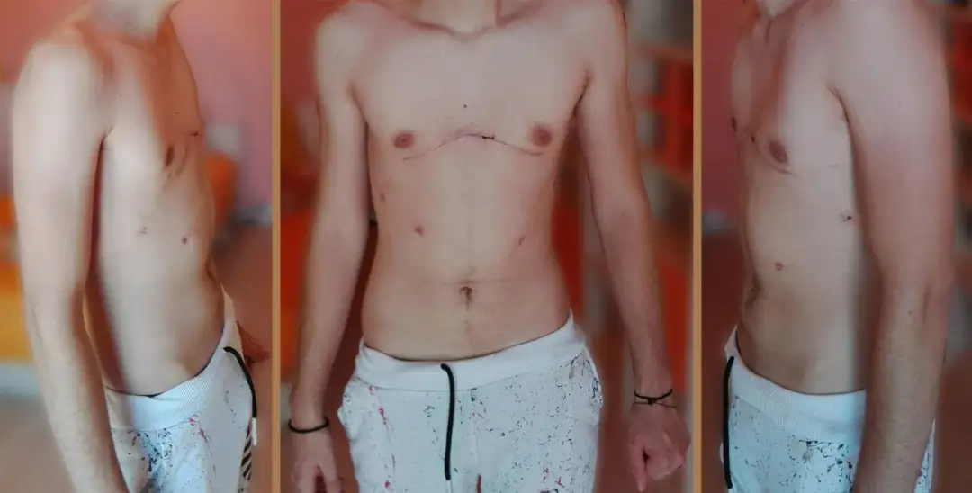 Pectus co znaczy po polsku? Łacińskie słowo w anatomii