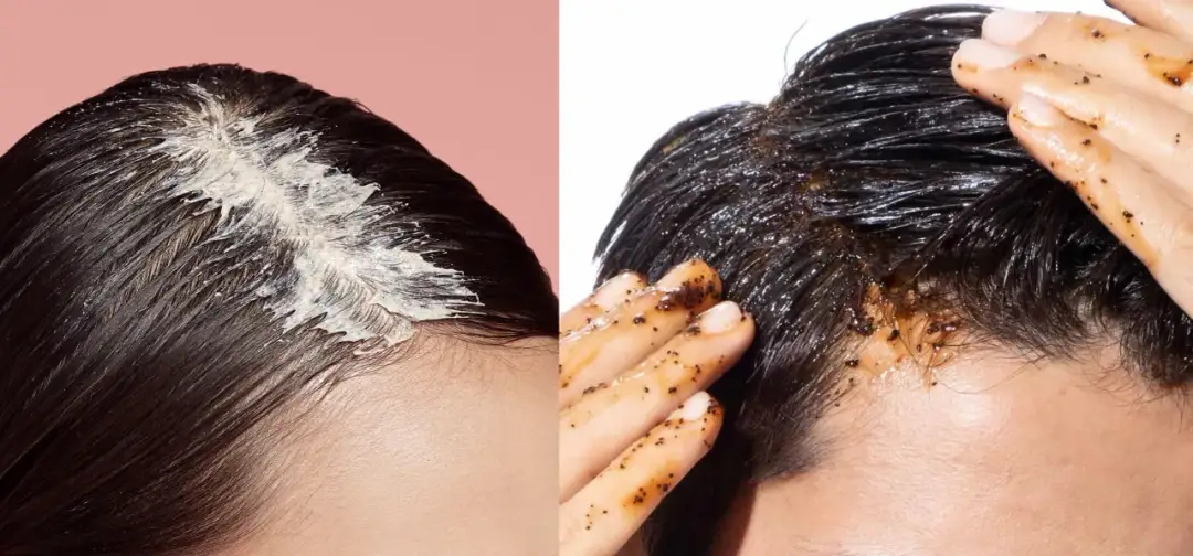 Jak prawidłowo wykonać peeling na łupież - skuteczne sposoby na zdrową skórę