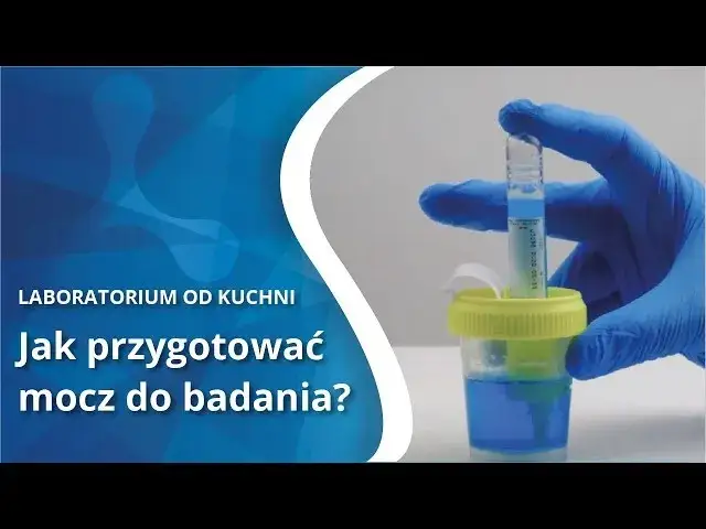Prawidłowe pobranie moczu do badania: Klucz do trafnej diagnozy