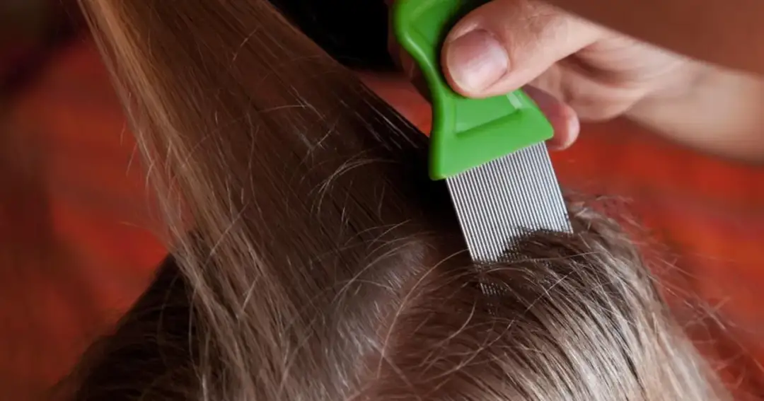 Kiedy dziecko z wszawicą może wrócić do przedszkola po leczeniu?