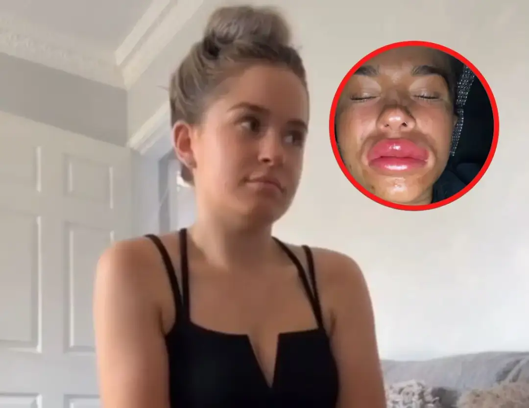 Czy można pić alkohol po powiększaniu ust? Ważne informacje o skutkach