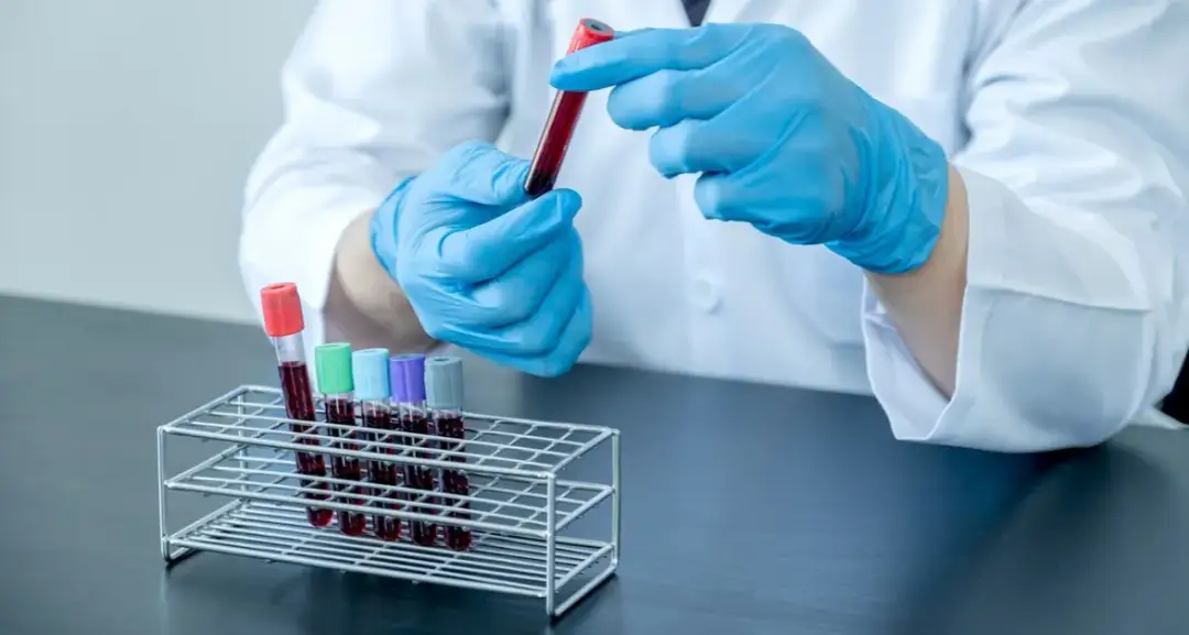 Test z kursu krwiodawstwa: Jak go zdać? Kluczowe zagadnienia