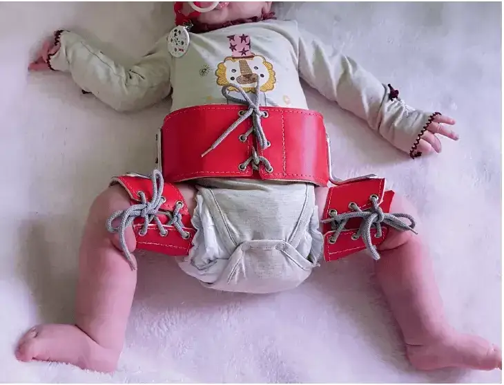 Problemy z bioderkami u niemowlaka: 7 kluczowych objawów