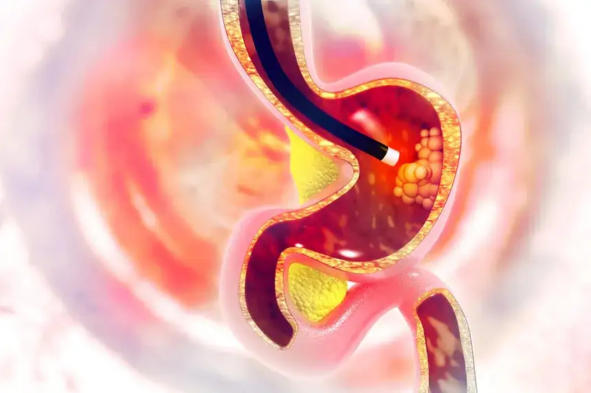 Czym są badania endoskopowe? Poznaj ich znaczenie i rodzaje