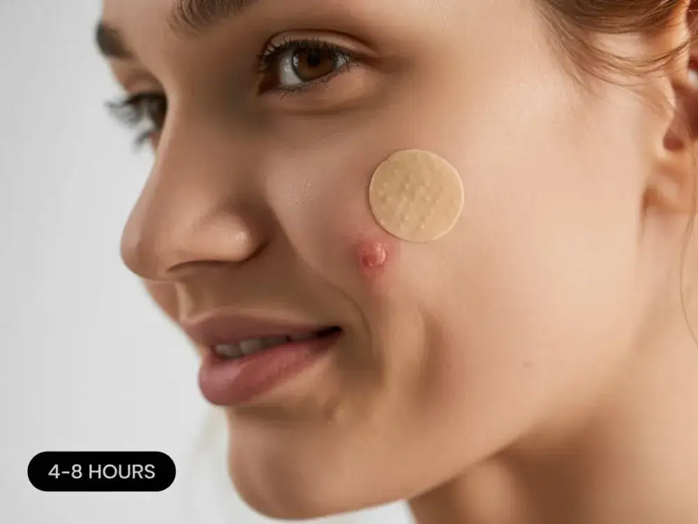 Maść ichtiolowa na pryszcze: Jak długo trzymać? Poradnik eksperta