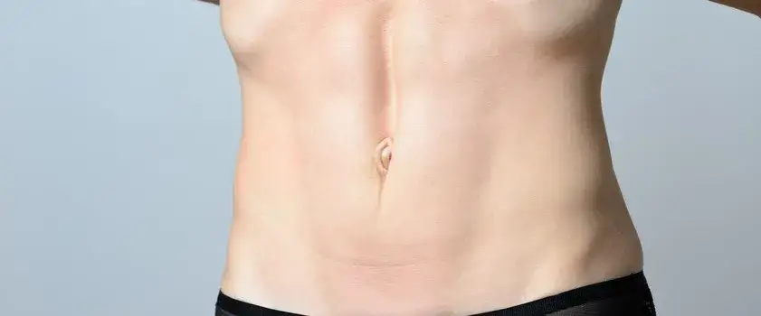 Linia biała – co to jest i jak wpływa na ciało oraz ciążę?