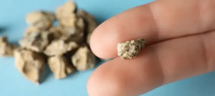 Radzenie sobie z kolką nerkową w ciąży: Skuteczne porady z forum