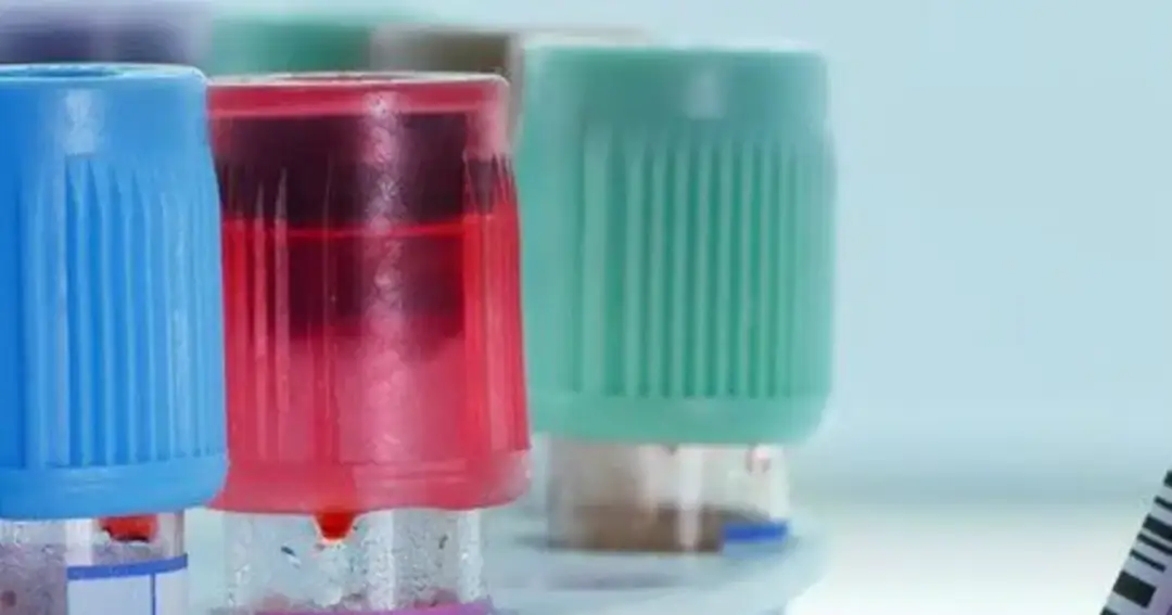 Podwyższony poziom NSE - co oznacza i kiedy powinieneś się niepokoić