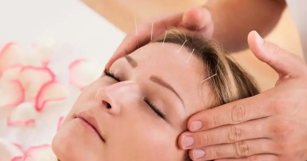 Czy akupunktura może zaszkodzić? Prawda o ryzyku i bezpieczeństwie