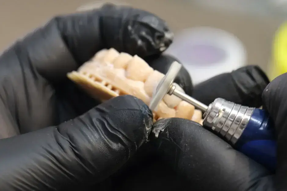 Czy implanty zębów można odliczyć od podatku? Sprawdź, jak to zrobić.