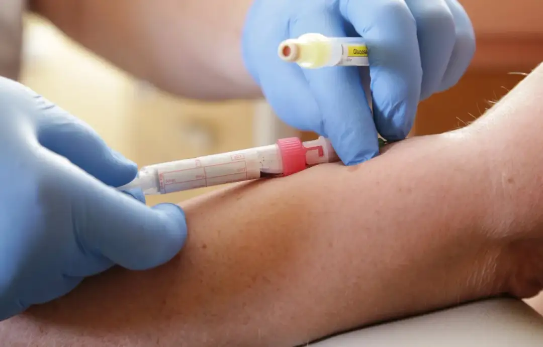 Co to jest lymph w badaniu krwi? Znaczenie i normy limfocytów Co to jest lymph w badaniu krwi? Znaczenie i normy limfocytów