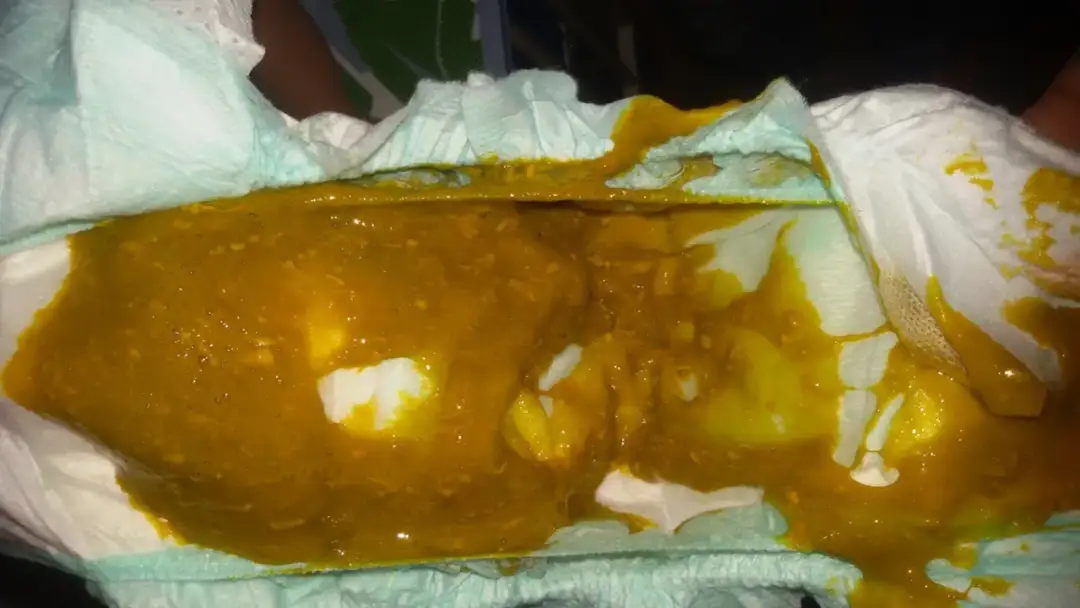 Kupka u 8-miesięcznego dziecka: Co jest normą, a co sygnałem alarmowym?