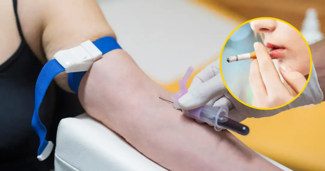 Ile przed badaniem krwi nie można palić, aby uniknąć błędnych wyników