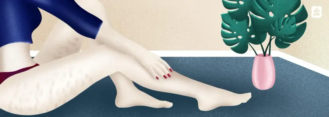 Gładkie uda bez cellulitu? Domowe sposoby, które naprawdę działają!