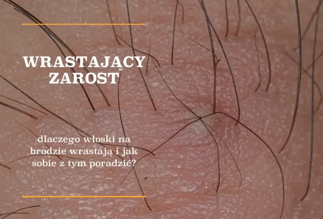 Gęstnienie zarostu: Wiek, geny, hormony co musisz wiedzieć?