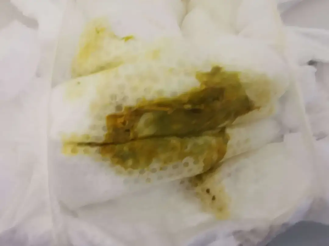 Jak wyglądają kupki przy ząbkowaniu? 7 ważnych informacji