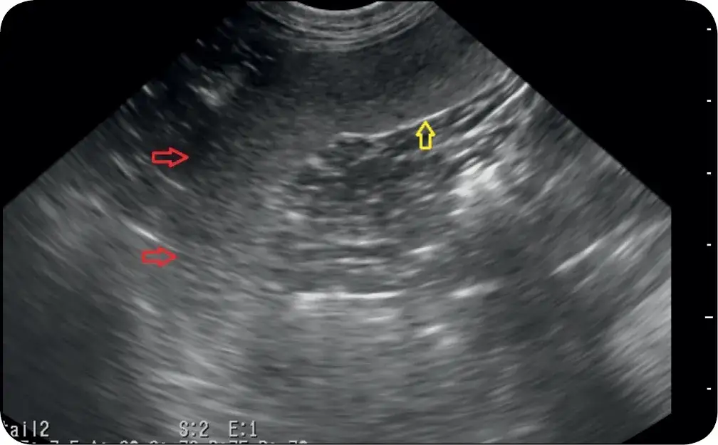 Śledziona u psa: jakie choroby jej dotyczą i jak skutecznie leczyć?