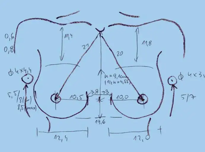 Czy hormony i geny decydują o wzroście biustu? Sprawdź kluczowe czynniki