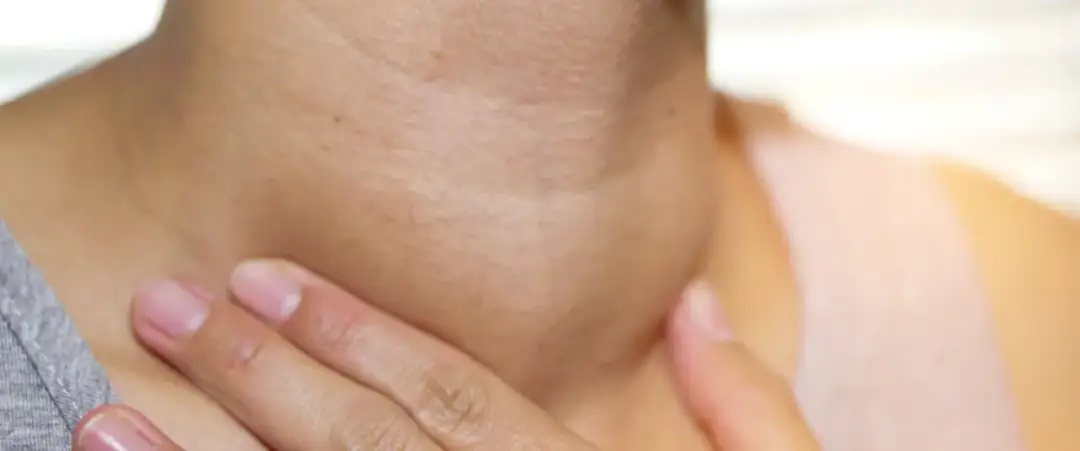 Pierwsze objawy wola tarczycy – jak je rozpoznać i co oznaczają