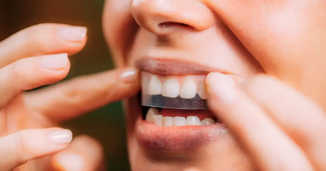 Wybielanie zębów w domu: co działa, a co szkodzi? Poradnik