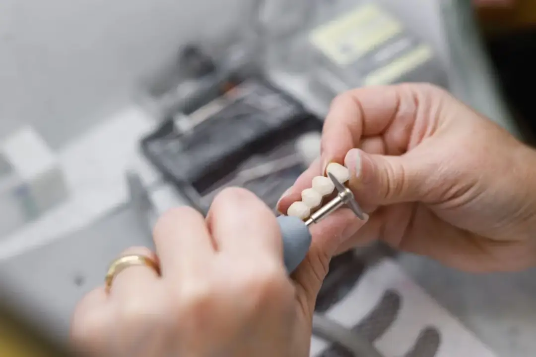 Most protetyczny: Ile zapłacisz? Ceny, rodzaje, most vs implant