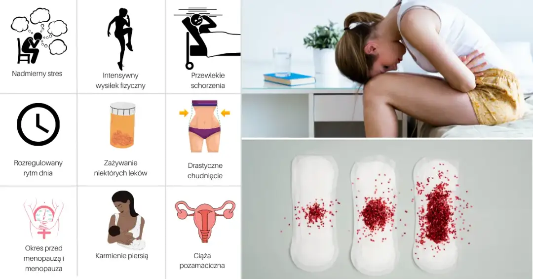 Miesiączka co 14 dni (polimenorea)? Poznaj przyczyny i leczenie!