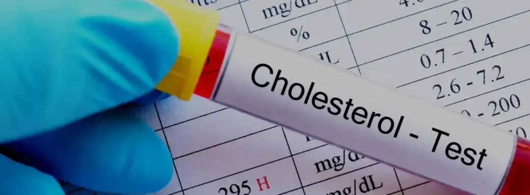 Czy cholesterol jest dziedziczny? Poznaj ryzyko i skutki zdrowotne