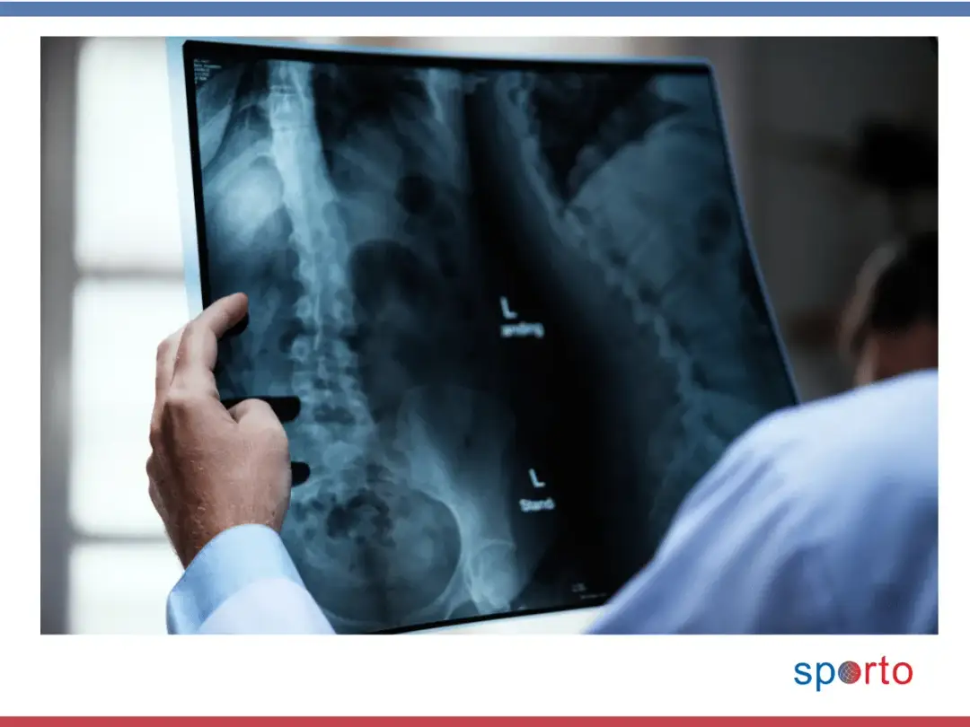 Co ile można robić RTG? Bezpieczna częstotliwość badań