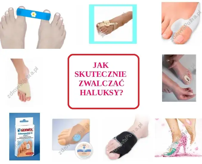 Skuteczna profilaktyka haluksów: Twój przewodnik do zdrowych stóp