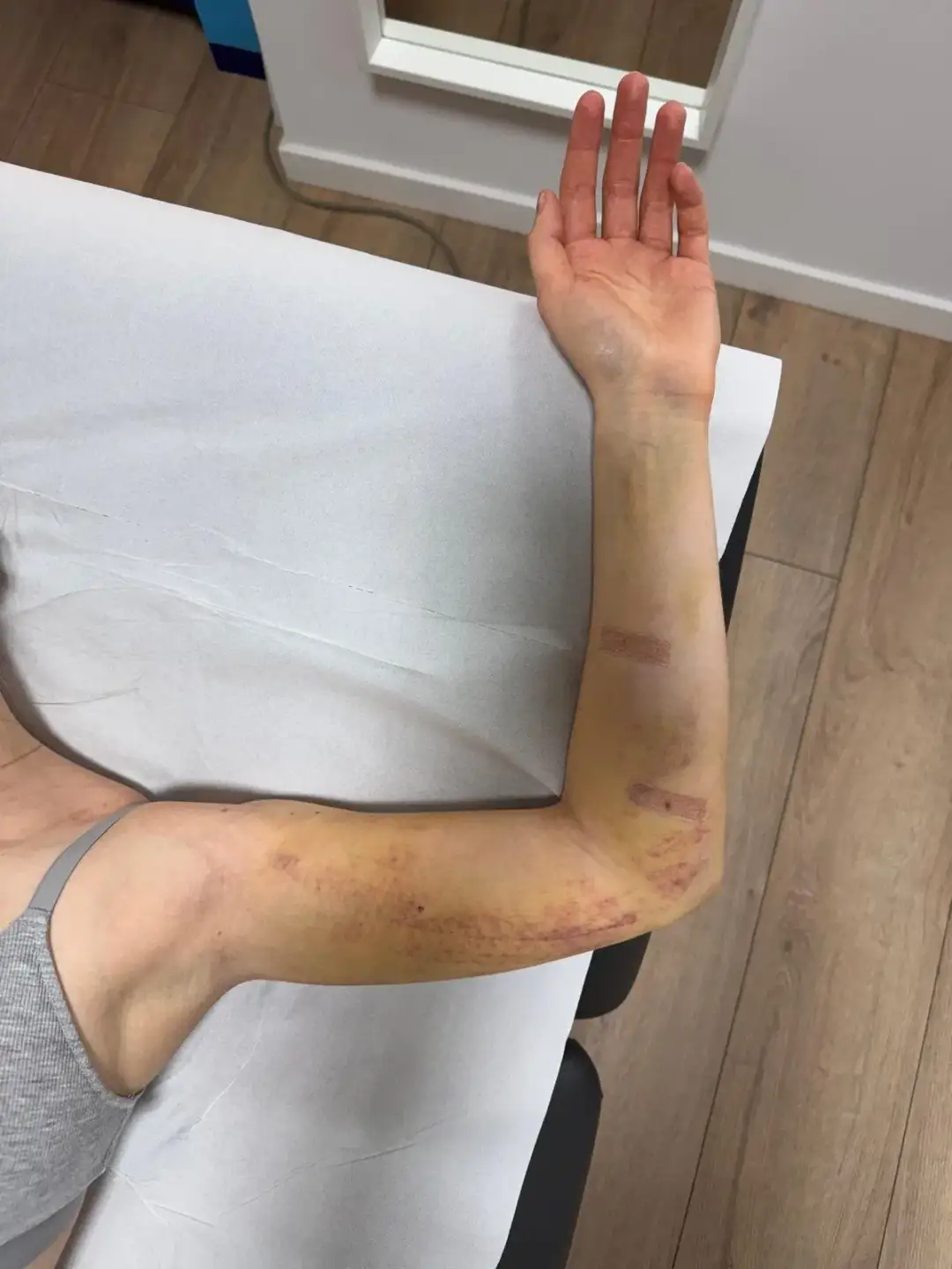 Fizjoterapia estetyczna – na czym polega?