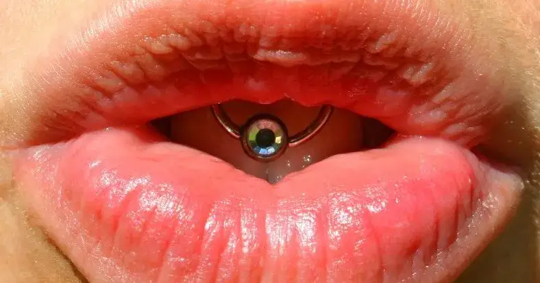 Czy kolczyk w języku niszczy zęby? Poznaj ryzyko i skutki zdrowotne