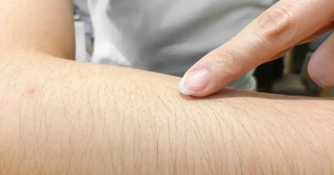 Jak golić ręce bez podrażnień - skuteczne techniki i porady