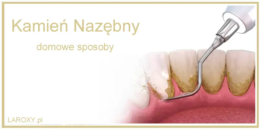 Jak usunąć kamień nazębny? Domowe mity i bezpieczne rozwiązania