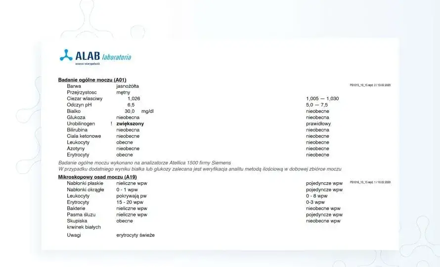 Ile siku do badania moczu? Kluczowe informacje o czasie i przygotowaniu