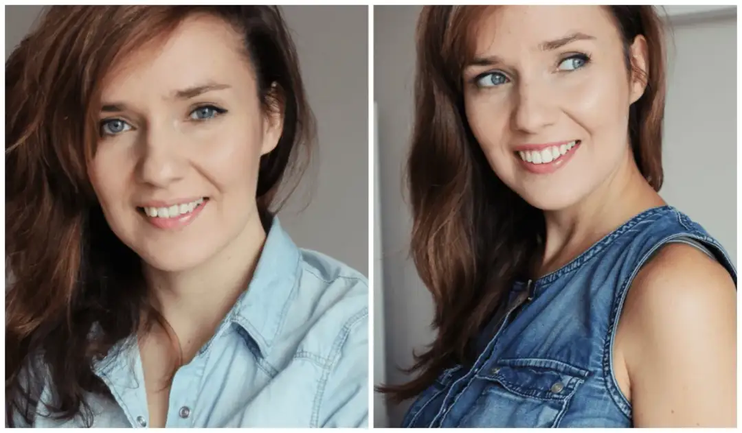 Założenie aparatu stałego: Ile trwa i czy boli? Pełny przewodnik