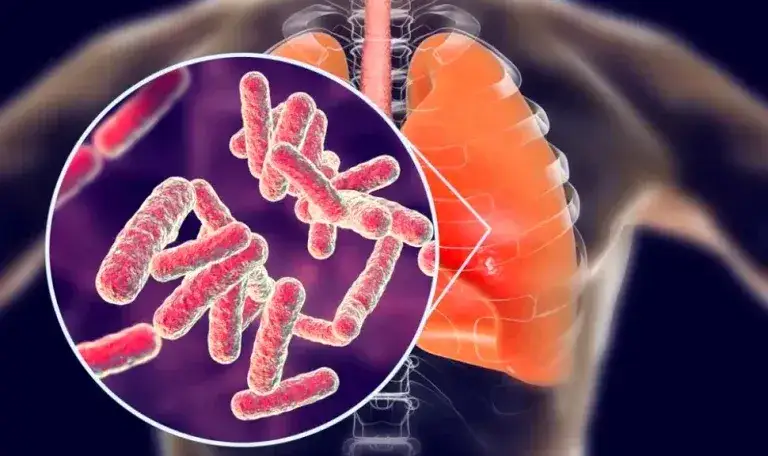 Kto wynalazł lek na gruźlicę i jakie były jego skutki?