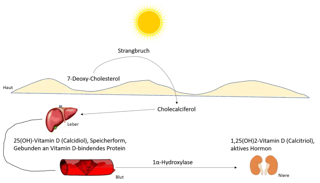 Vitamin D Mangel: Ursachen, Symptome und effektive Lösungen für Ihre Gesundheit